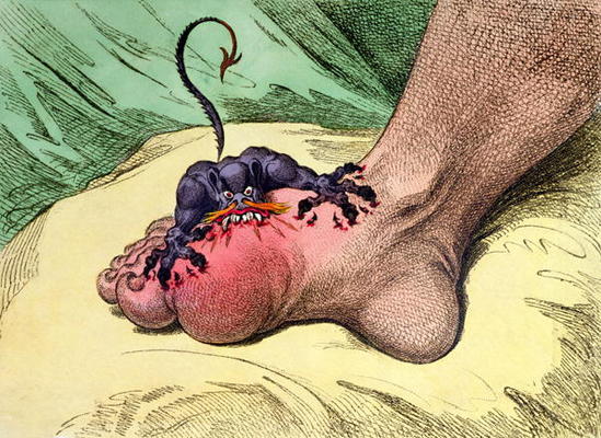 The Gout, published by Hannah Humphrey in 1799 (hand-coloured softdground etching) van James Gillray