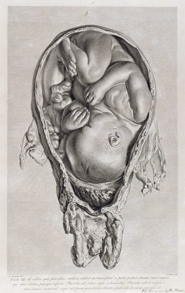Anatomical drawing of a foetus in the womb van Jan van Rymsdyk