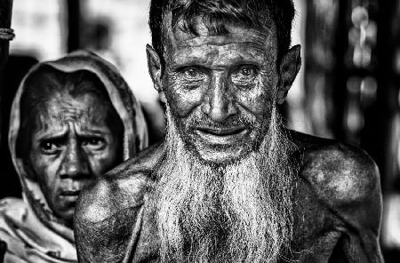 Elderly Rohingya refugee - Bangladesh